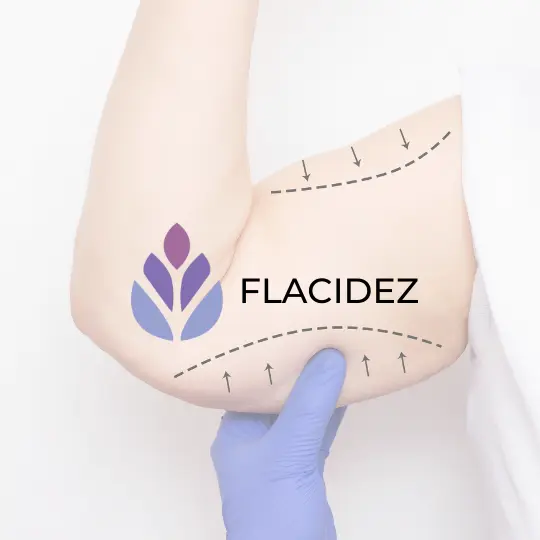 Flacidez