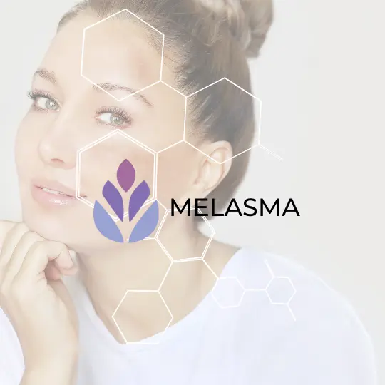 Melasma